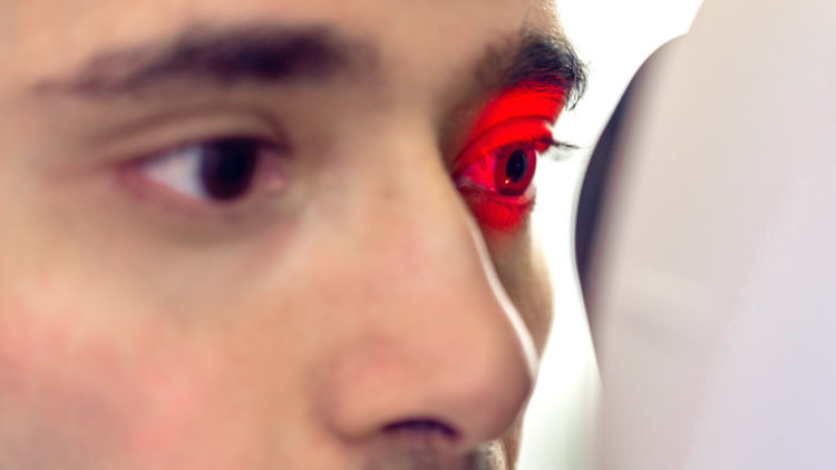 Сканирование сетчатки глаза