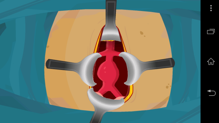 Осторожно: абсурдные игры в Google Play! Virtual Surgery : Surgery Game. Осторожно: абсурдные игры в Google Play! Virtual Surgery : Surgery Game. Фото.