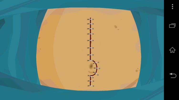 Осторожно: абсурдные игры в Google Play! Virtual Surgery : Surgery Game. Осторожно: абсурдные игры в Google Play! Virtual Surgery : Surgery Game. Фото.