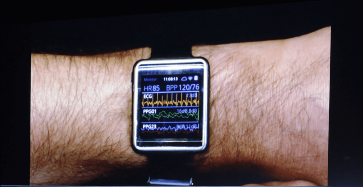 Samsung собирается обойти Apple в слежении за здоровьем с помощью Simband. Фото.