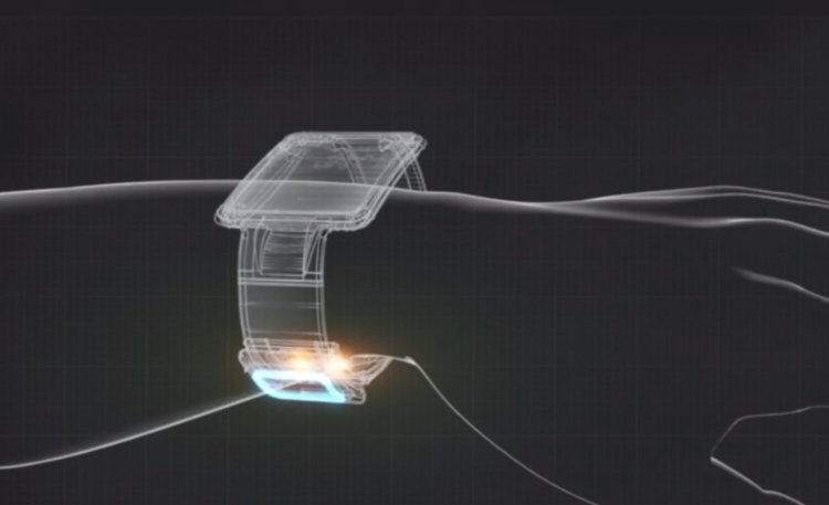 Samsung собирается обойти Apple в слежении за здоровьем с помощью Simband. Фото.