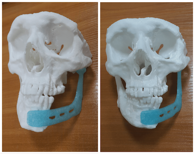 То, чего вы не знали о 3D-печати. 3D-печать в медицине. Фото.