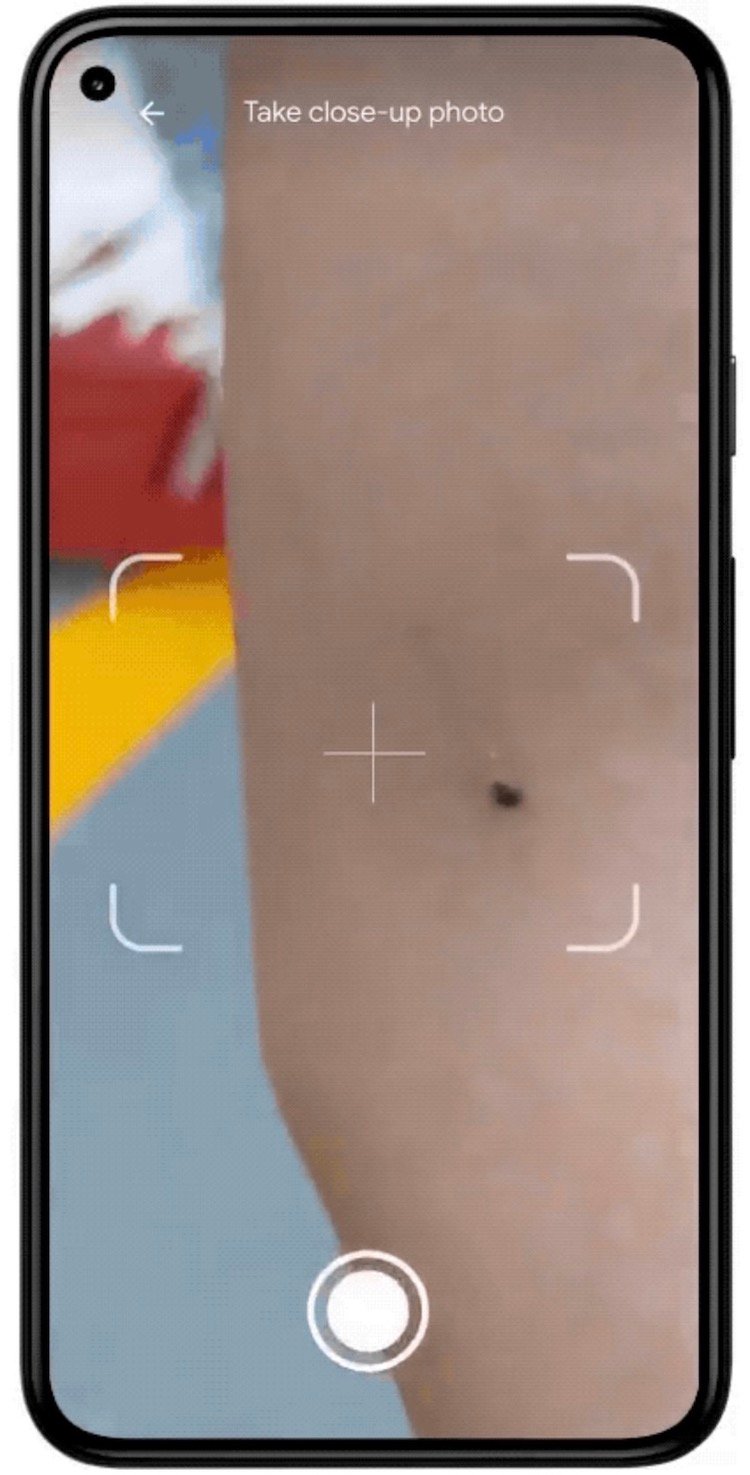 Что показали на Google I/O 2021. Наводите камеру на подозрительный участок кожи и получаете результат. Фото.