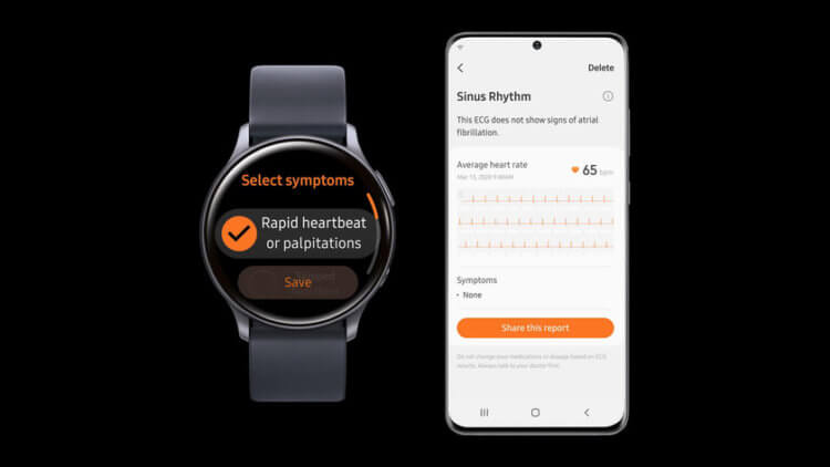 Контроль здоровья в Galaxy Watch. Приложение Samsung Health Monitor доступно только для смартфонов компании. Фото.